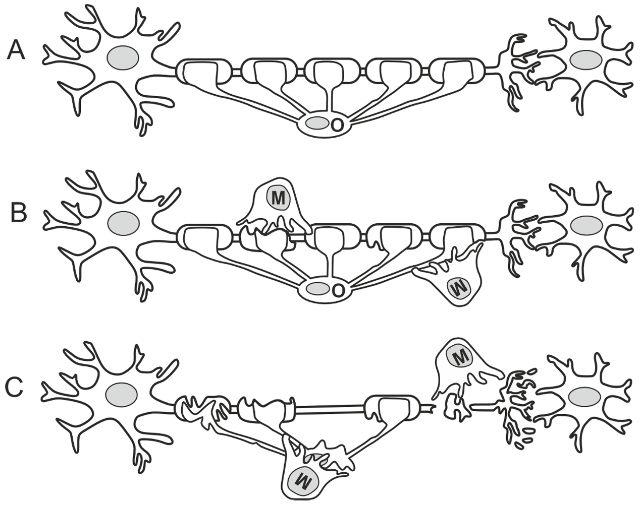 Schematische Darstellung von drei Neuronen mit Axonen und Myelinscheiden in unterschiedlichen Zuständen.